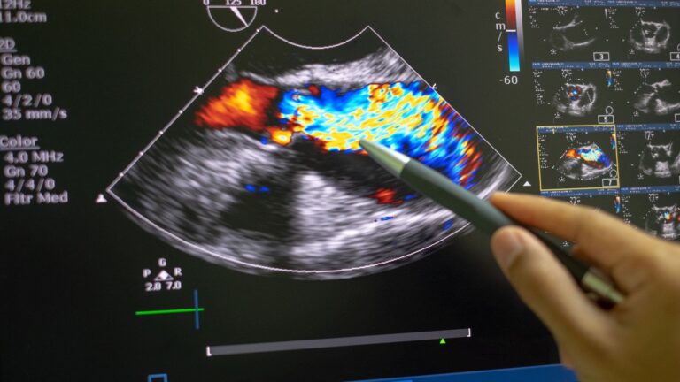 does red and blue on ultrasound mean cancer