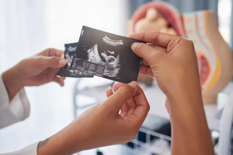 Sonogram vs Ultrasound Pregnancy 2