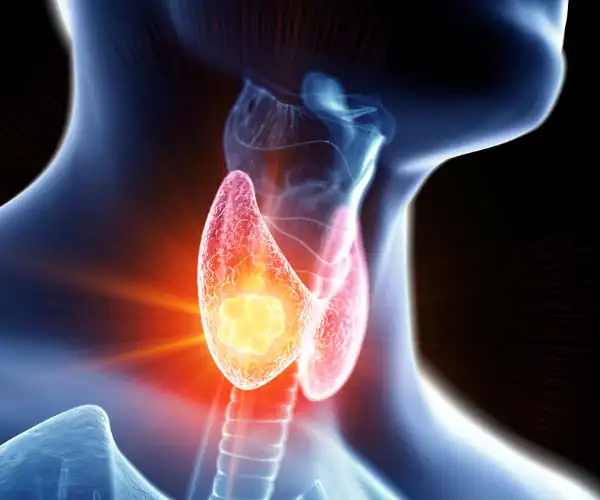 what does a thyroid ultrasound show 2