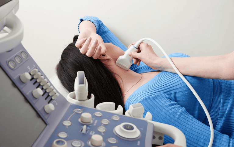 carotid doppler ultrasound