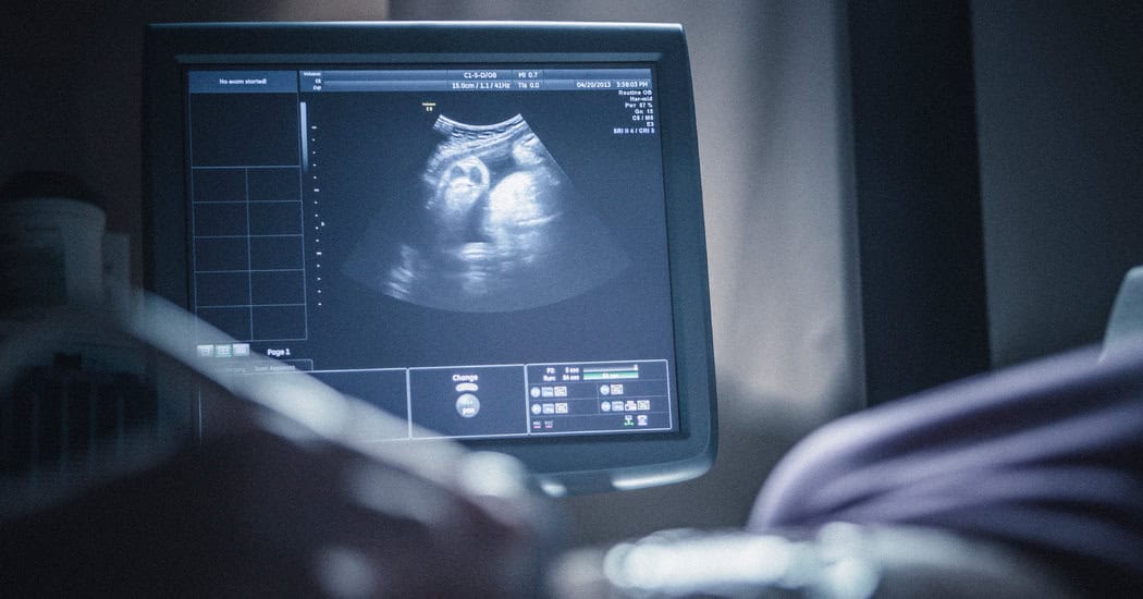 what to expect during an ultrasound scan