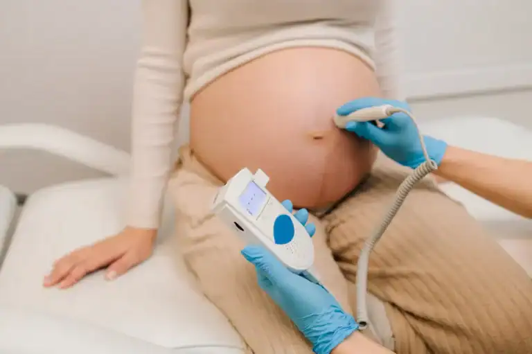 what is a doppler ultrasound and what does it detect 2