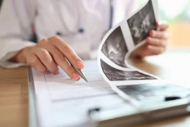 how long does it take to get ultrasound results 2