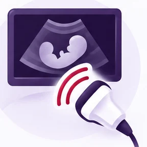Illustration of a transducer and an ultrasound image on a monitor
